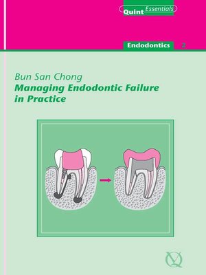 cover image of Managing Endodontic Failure in Practice